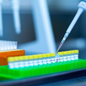 Total RNA Mini Extraction